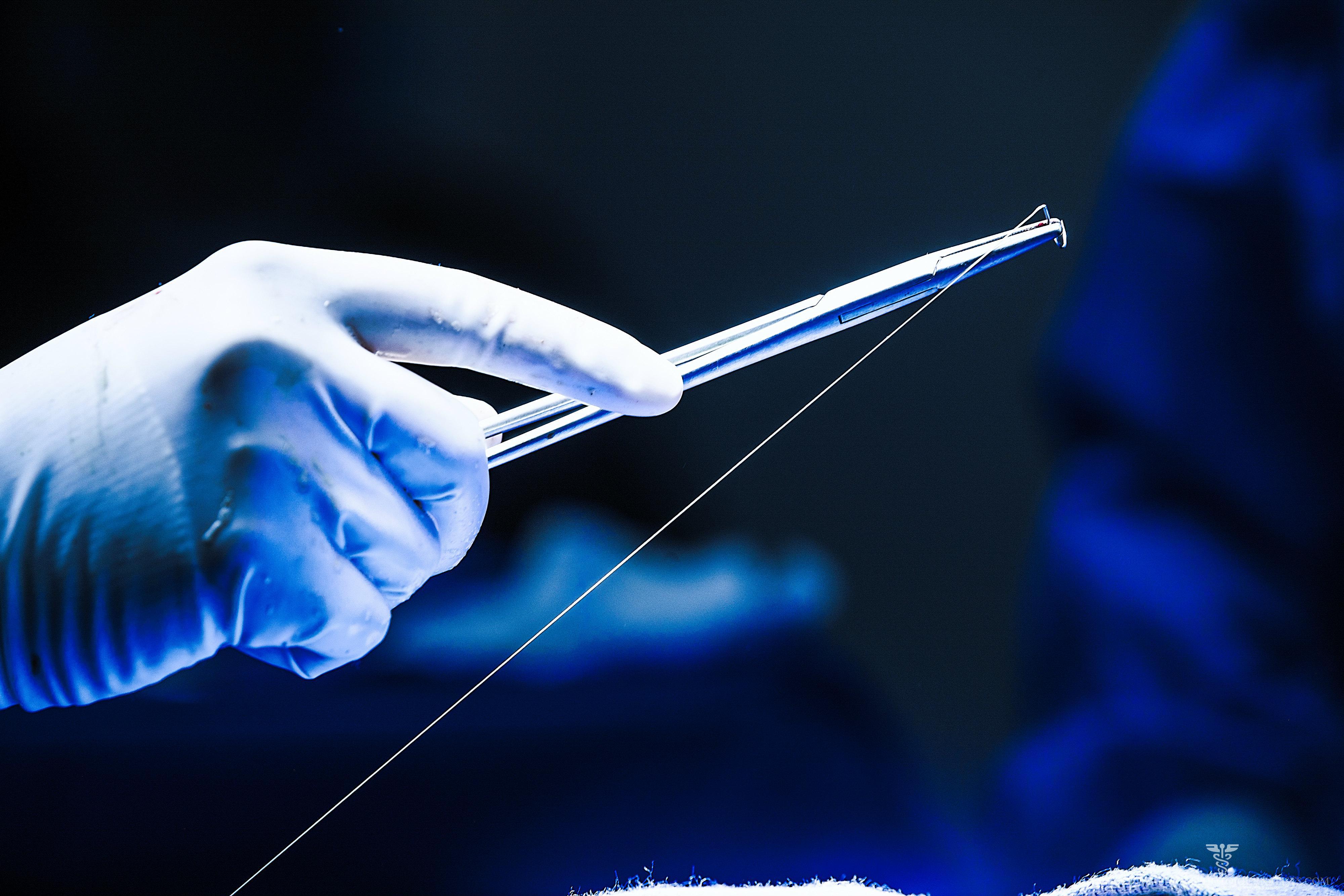 Minimally invasive surgery Los Angeles
